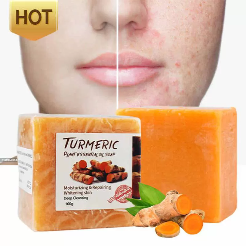 Wholesale Private Label Organic Natural Ginger Tumeric Anti Acne Dark Spots Removal Whitening Turmeric Soap 